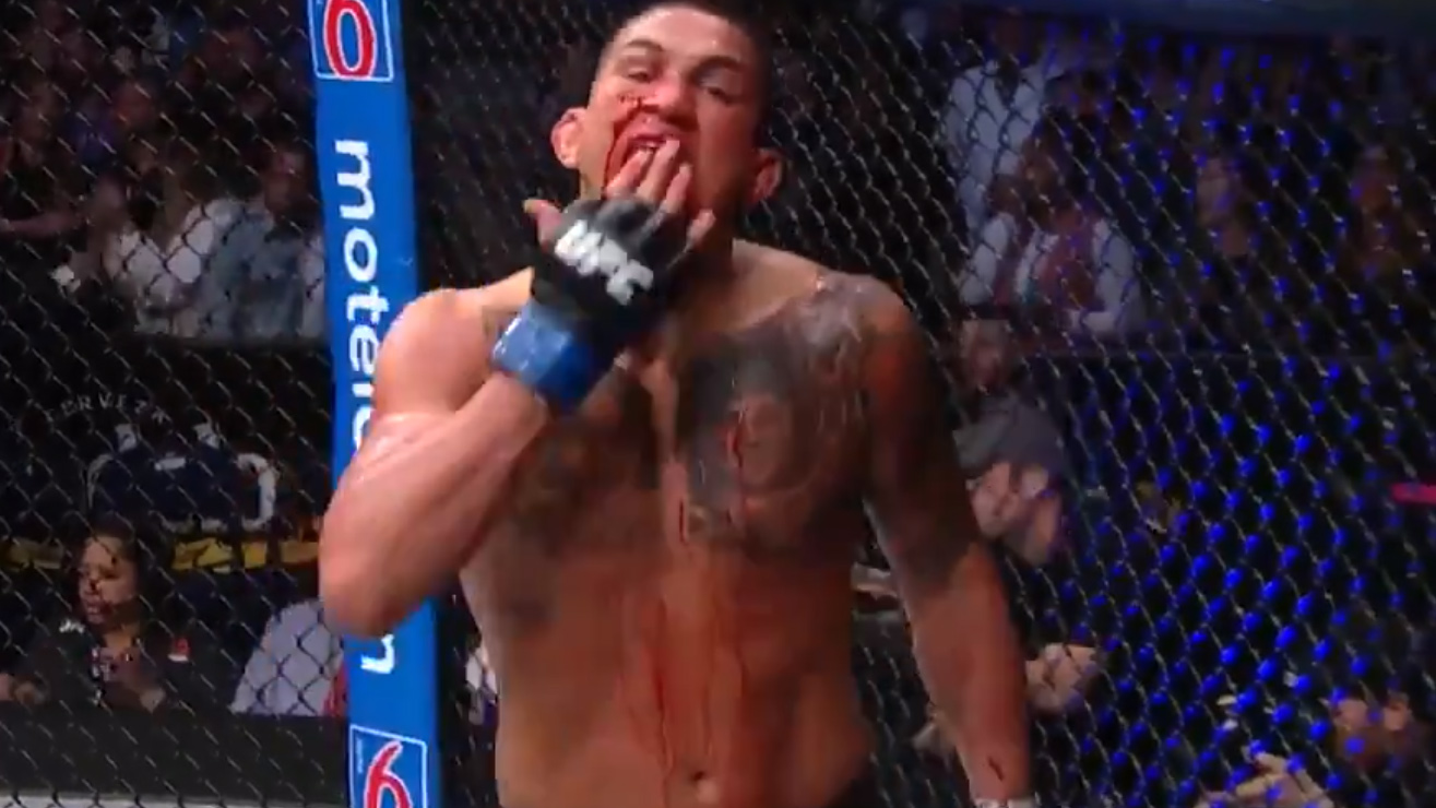 Anthony-Pettis-postfight-vs-Stephen-Thompson