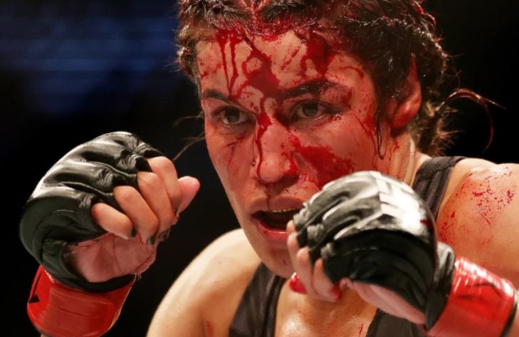 Dana White parla delle condizioni di Juliana Pena dopo la sconfitta contro Amanda Nunes a UFC 277: “Ha bisogno di vedere un chirurgo plastico”