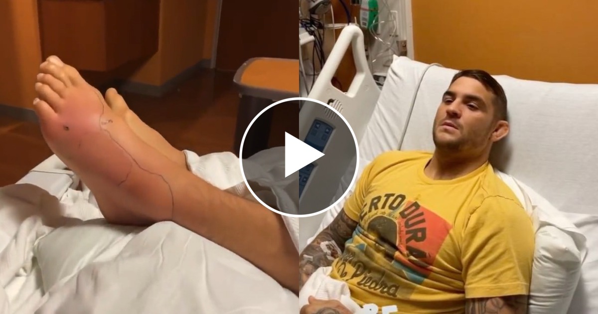 Dustin Poirier partage une vidéo de son pied déformé depuis l’hôpital