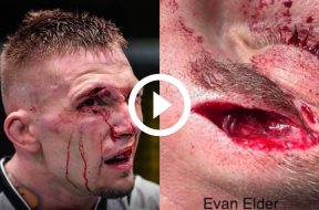 Evan Elder