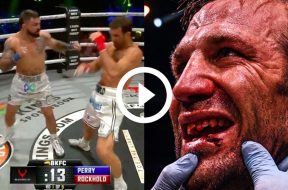 Mike-Perry-Luke-Rockhold-blessure