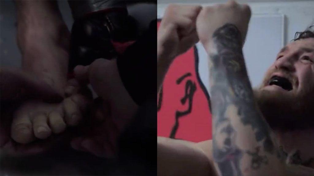 Conor McGregor s'est brutalement cassé le pied avant son combat contre Khabib, voici les images