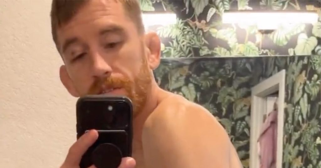 Cory Sandhagen dévoile les images de sa terrible blessure au coude après l'UFC Nashville