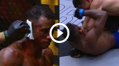 Vinicius-Cruz-Oreille
