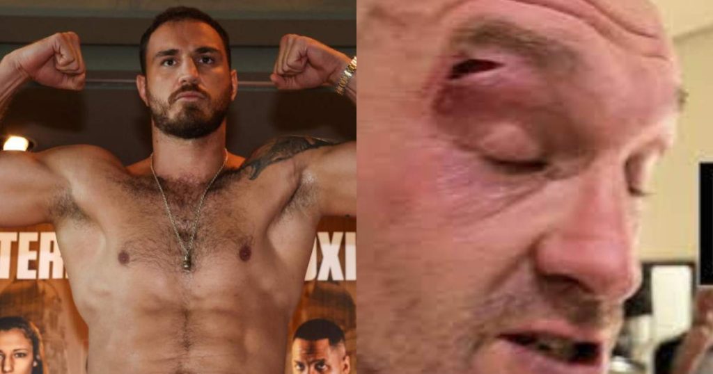 Tyson fury blessure