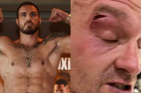 blessure-tyson-fury-boxe