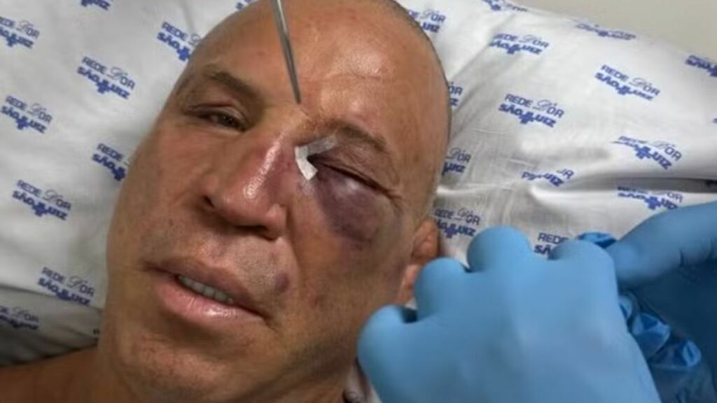 Wanderlei Silva réagit après le K.-O. qu'il a subi dans un brawl général, son état est grave