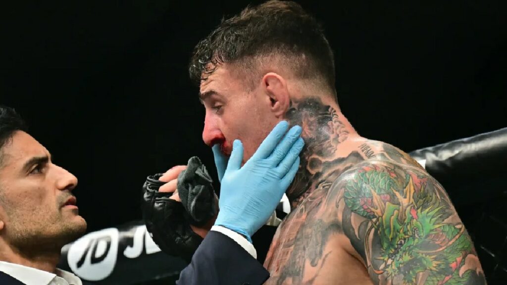 Poirier réagit au eye poke sur Tom Aspinall