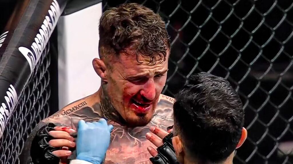 Le père de Tom Aspinall répond aux critiques sur le mental de son fils