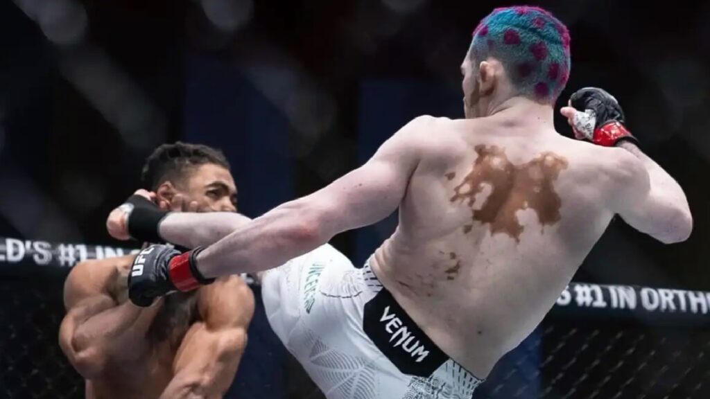 Le dernier adversaire de Morgan Charri&egrave;re, Melquizael Costa, fait un bond de 20kg en 9 jours