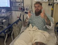 jake-paul-blessure-machoire-fracture-joshua-boxe