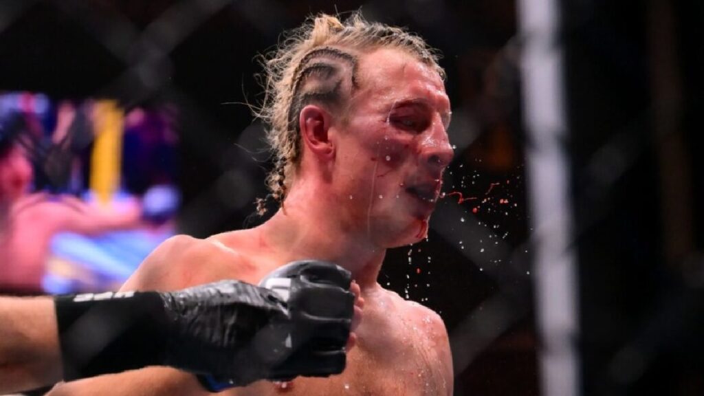 Paddy Pimblett marqu&eacute; physiquement : les images de son visage trois jours apr&egrave;s le combat contre Justin Gaethje