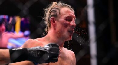 Paddy-Pimblette-s&eacute;quelles-visage-amoch&eacute;-combat-Justin-Gaethje-ufc-324