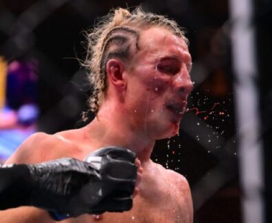 Paddy-Pimblette-s&eacute;quelles-visage-amoch&eacute;-combat-Justin-Gaethje-ufc-324