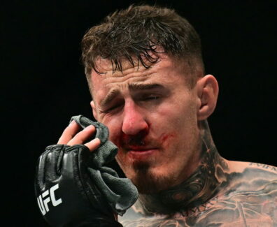 ophtalmologue-commente-blessure-operation-aspinall-ufc