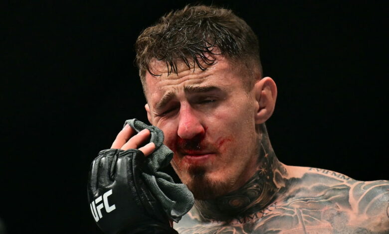 ophtalmologue-commente-blessure-operation-aspinall-ufc