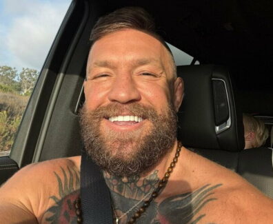 conor-mcgregor-blessure-ufc-329